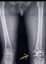 X-ray icon