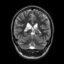 Open Brain icon